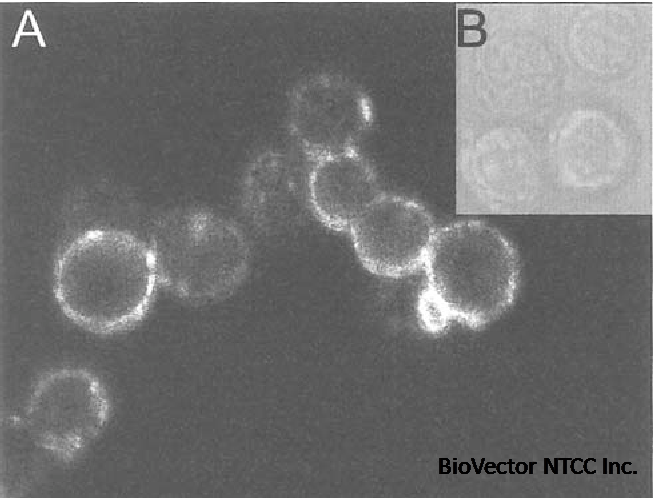 Human sarcoma cell lines MES-SA and MES-SA/Dx5 as a model ...