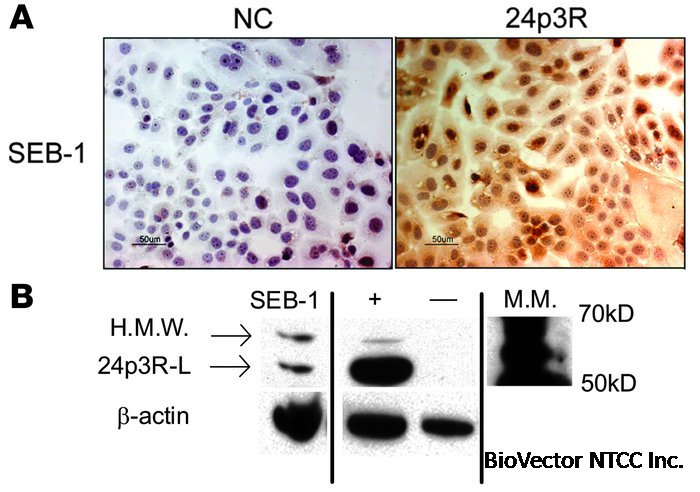 JCI - Neutrophil gelatinase–associated lipocalin mediates 13-cis retinoic  acid–induced apoptosis of human sebaceous gland cells