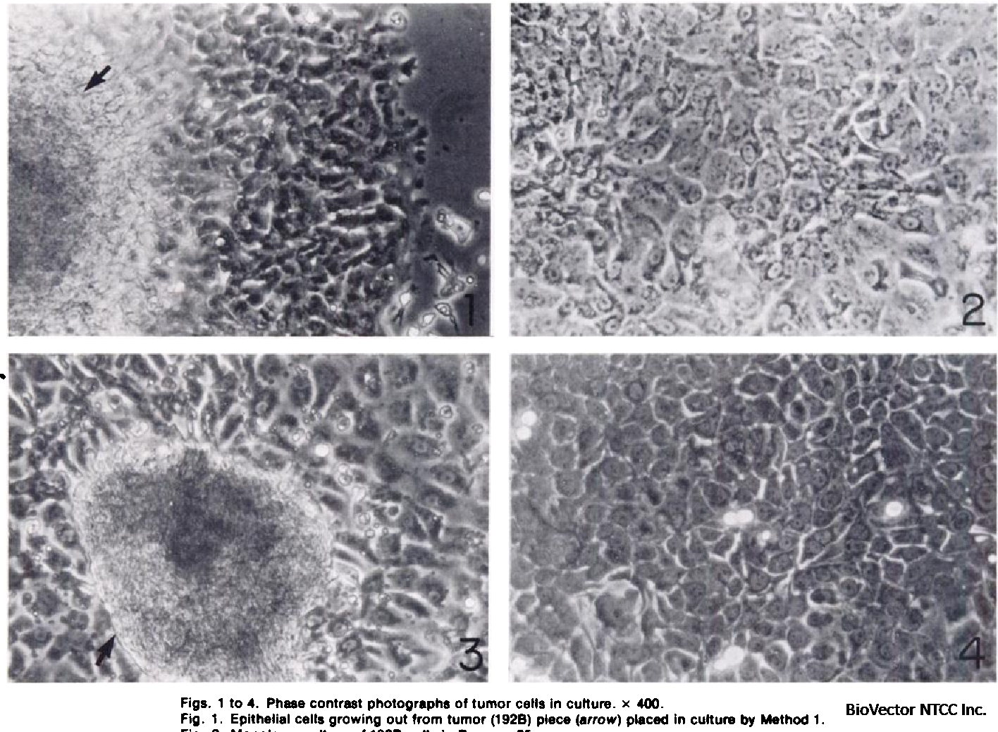 PDF] In vitro cultivation of epithelial cells derived from tumors of the  human urinary tract. | Semantic Scholar