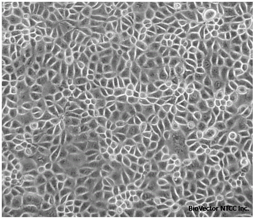 Domestication method of full suspension culture type Marc-145 cell line -  Eureka | Patsnap