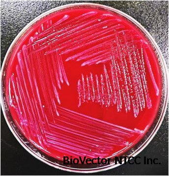 The first case of Odoribacter splanchnicus bacteremia isolated from a  patient in China - ScienceDirect