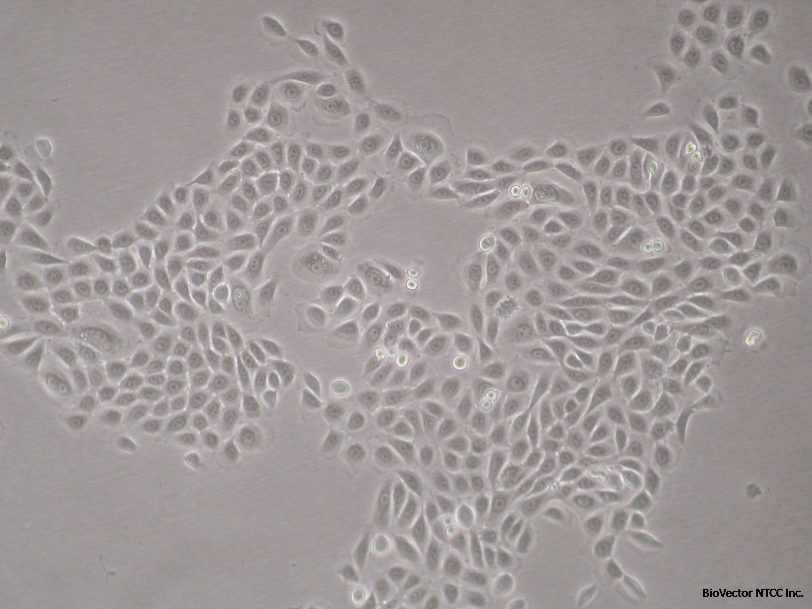 Normal Human Epidermal Keratinocytes | MatTek Life Sciences