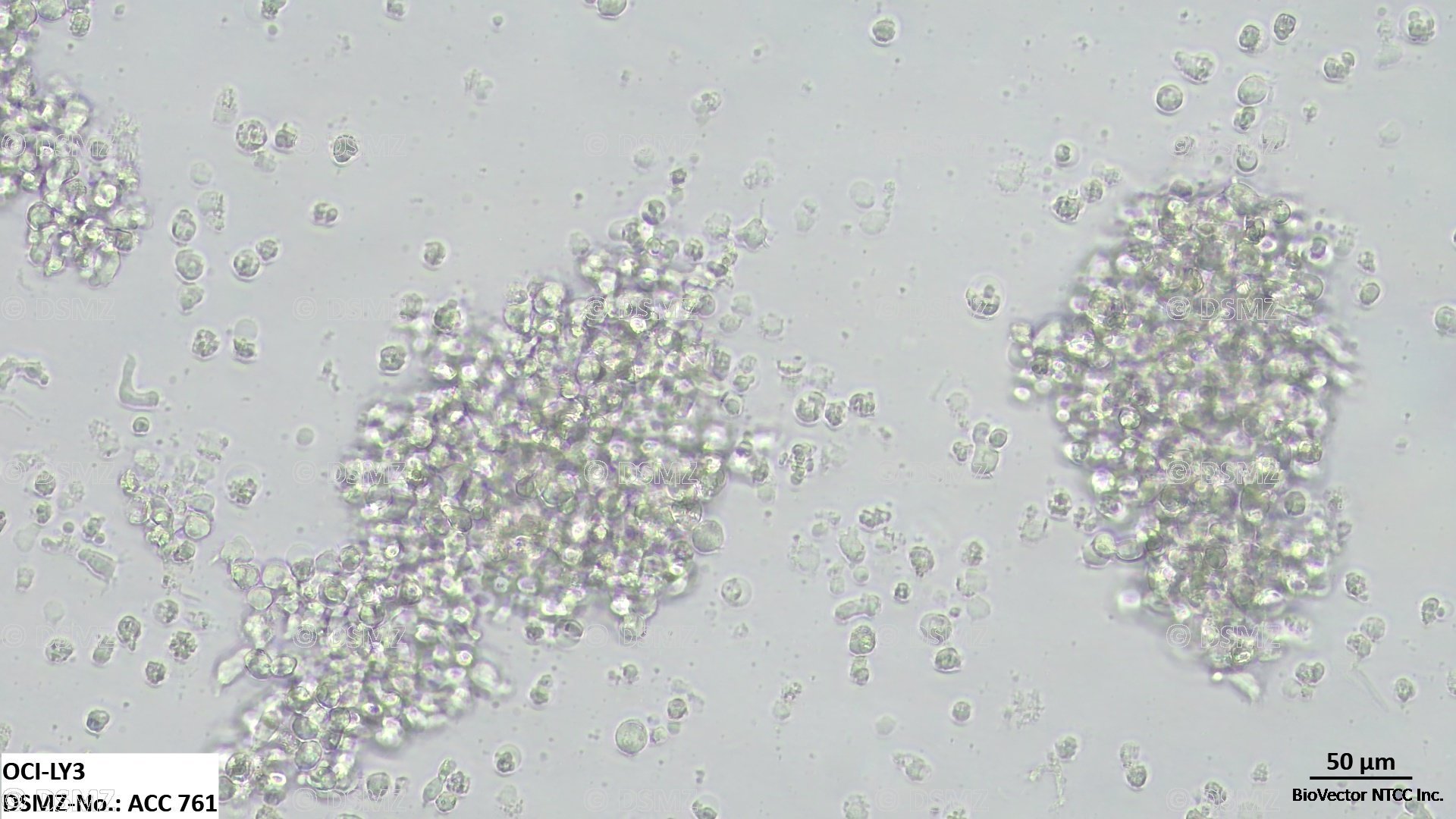 German Collection of Microorganisms and Cell Cultures GmbH:Welcome to the  Leibniz Institute DSMZ | OCI-LY3