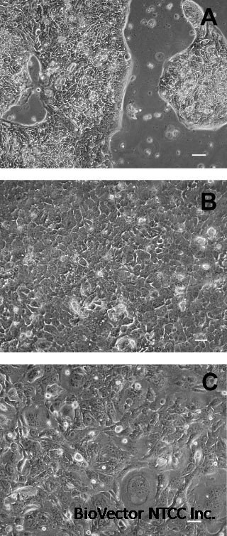 Establishment and characterisation of six human biliary tract cancer cell  lines | British Journal of Cancer