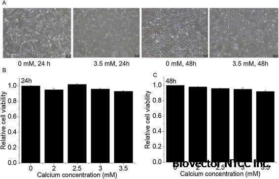 Calcium promotes differentiation in ameloblast-like LS8 cells by  downregulation of phosphatidylinositol 3 kinase /protein kinase B pathway -  ScienceDirect