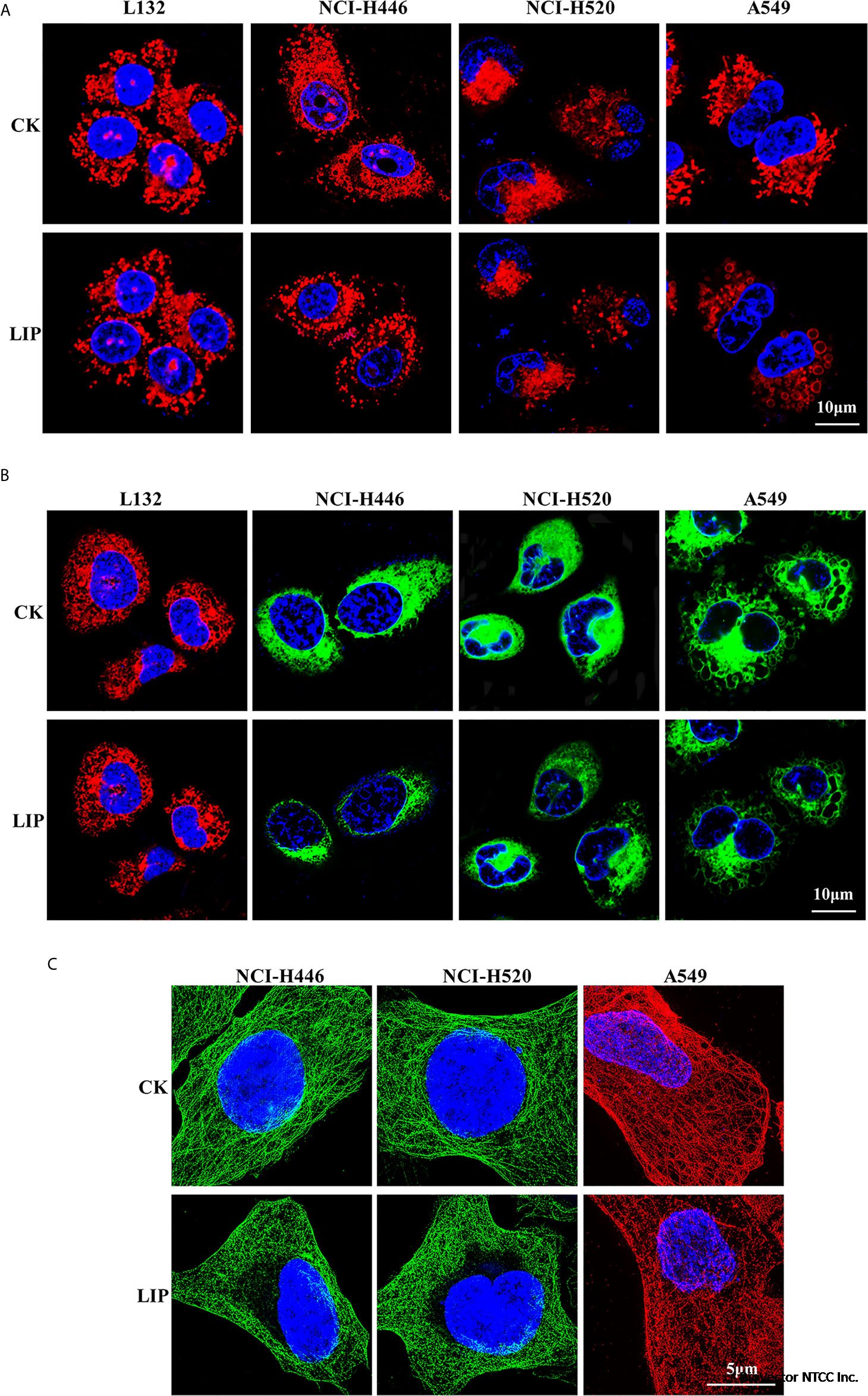 Frontiers | Lamprey Immune Protein Mediates Apoptosis of Lung Cancer Cells  Via the Endoplasmic Reticulum Stress Signaling Pathway