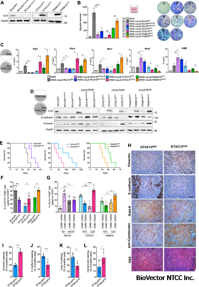 CCL3 predicts exceptional response to TGFβ inhibition in basal-like pancreatic cancer enriched in LIF-producing macrophages | npj Precision Oncology
