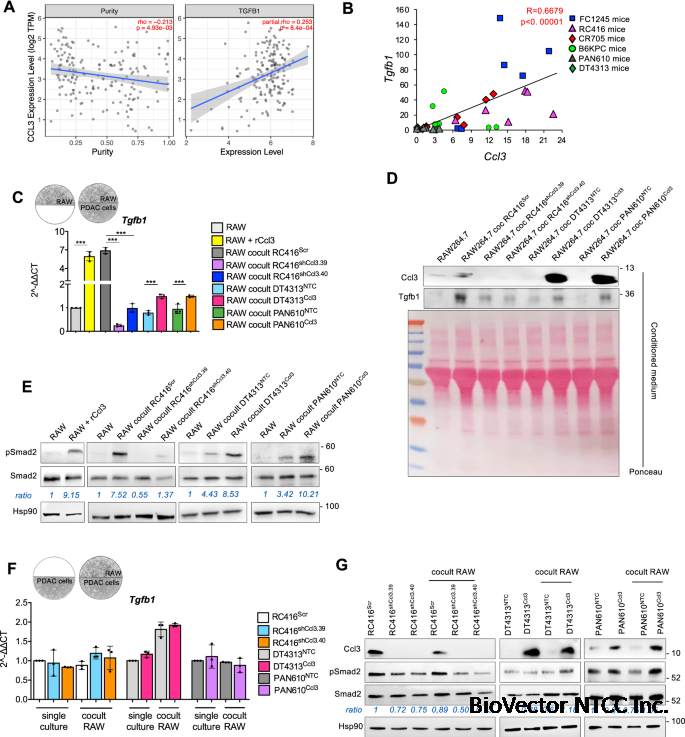 CCL3 predicts exceptional response to TGFβ inhibition in basal-like pancreatic cancer enriched in LIF-producing macrophages | npj Precision Oncology