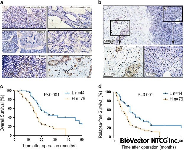 Cancer-FOXP3 directly activated CCL5 to recruit FOXP3+Treg cells in  pancreatic ductal adenocarcinoma | Oncogene