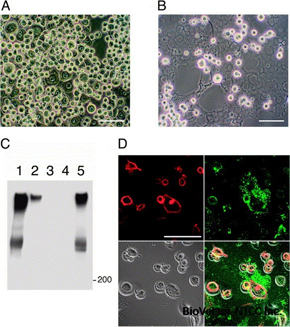Establishment and characterization of a parietal endoderm-like cell line derived from Engelbreth–Holm–Swarm tumor (EHSPEL), a possible resource for an engineered basement membrane matrix - ScienceDirect