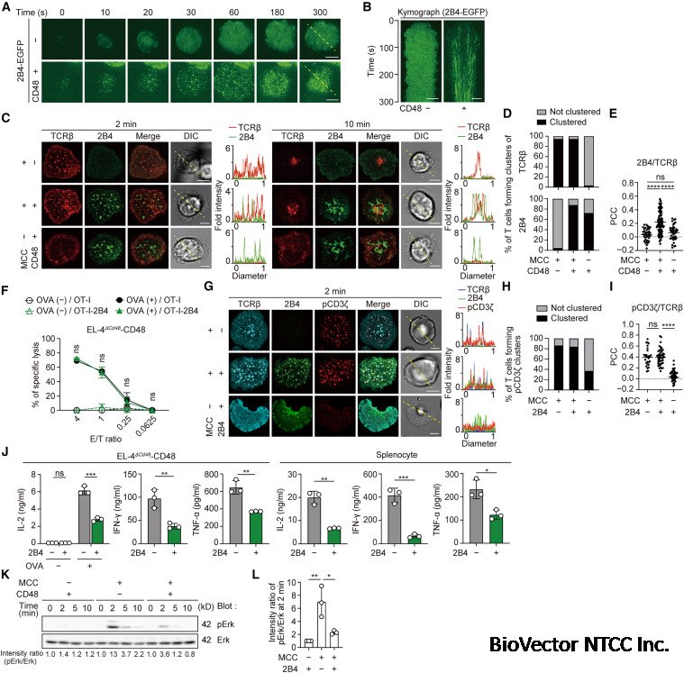Imaging of biphasic signalosomes constructed by checkpoint receptor 2B4 in  conventional and chimeric antigen receptor-T cells - ScienceDirect