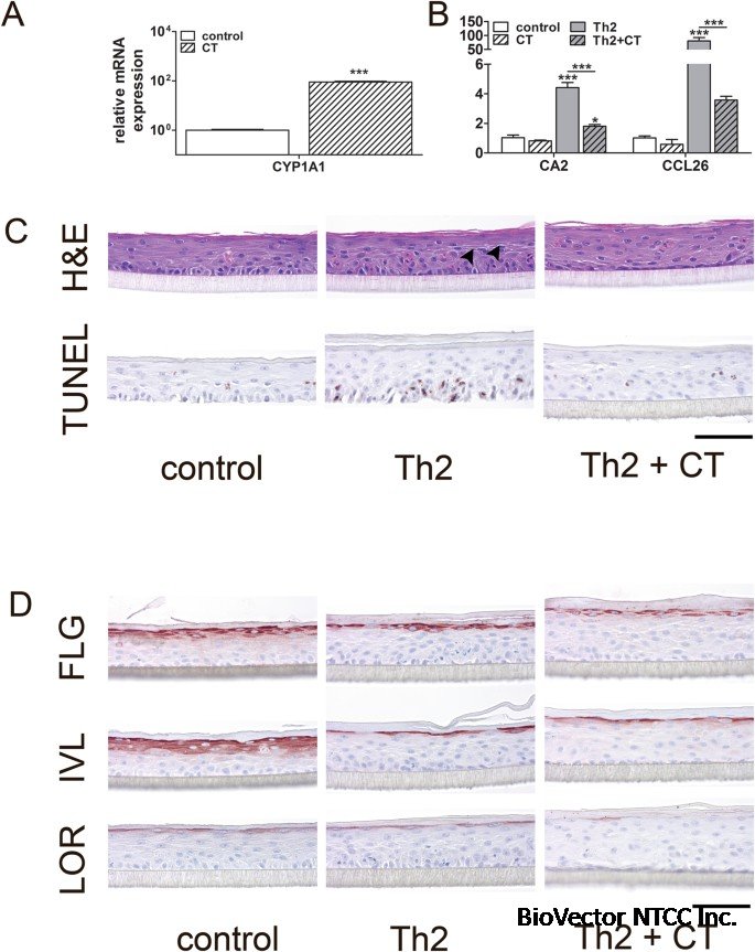 Immortalized N/TERT keratinocytes as an alternative cell source in 3D human  epidermal models | Scientific Reports