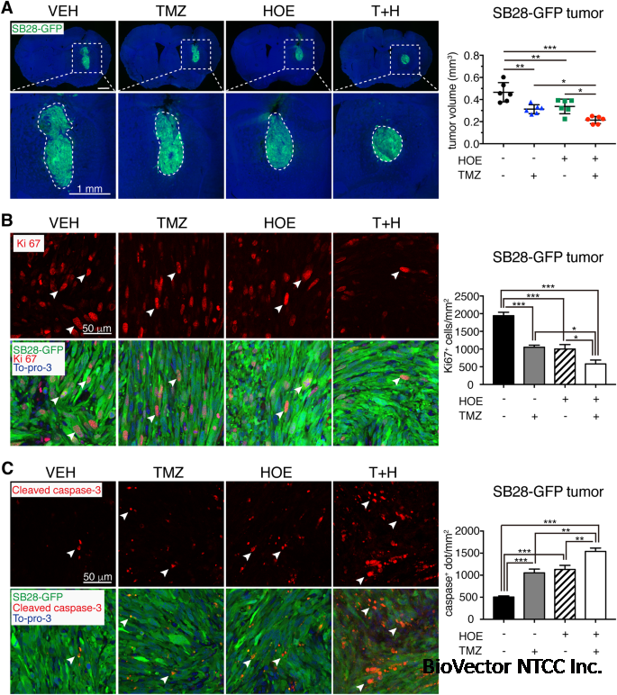 Blockade of Na/H exchanger stimulates glioma tumor immunogenicity and  enhances combinatorial TMZ and anti-PD-1 therapy | Cell Death & Disease