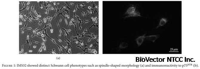 Immortalized Mouse Schwann Cells (IMS32) | Applied Biological Materials Inc.