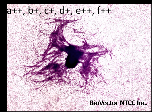Non Animal Testing, Alternative Test Methods, In Vitro Toxicology, IIVS | Bhas  42 Cell Transformation Assay