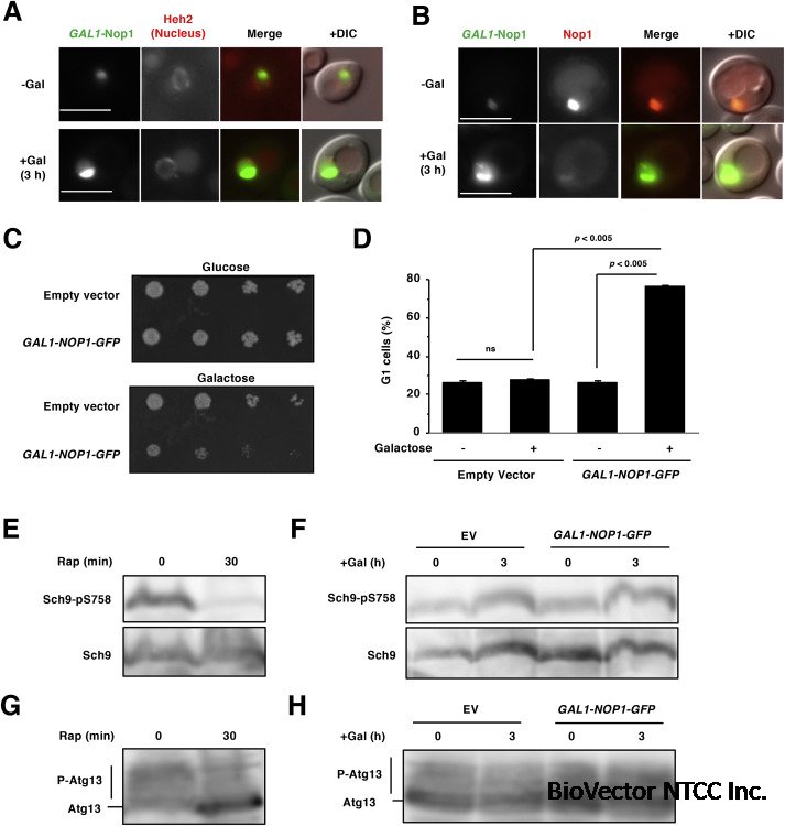 Def1 mediates the degradation of excess nucleolar protein Nop1 in budding yeast - ScienceDirect
